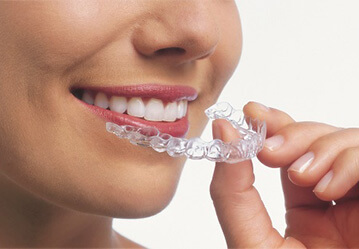 Invisalign Edmonton
